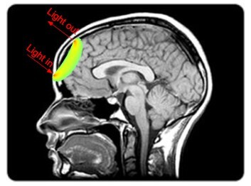 Inside Open-MOTION: How We’re Using Light to Detect Stroke in Minutes